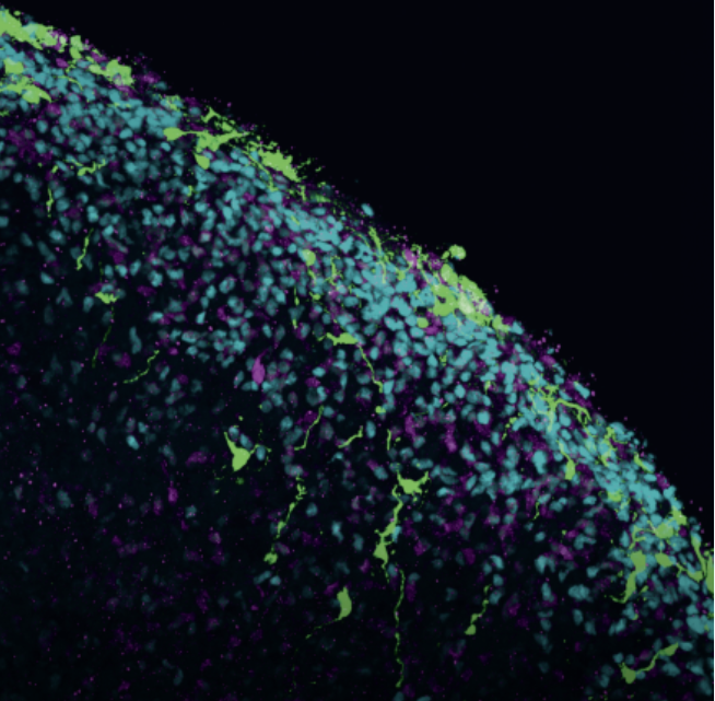 Slices of multiple Week 8 mini-brain organoids with neural stem cells seen in red and cortical neurons seen in green. The layered arrangement of these cells in the organoids resembles the natural architecture of the developing brain. Credit: Hajime Ozaki, Watanabe lab/UCI