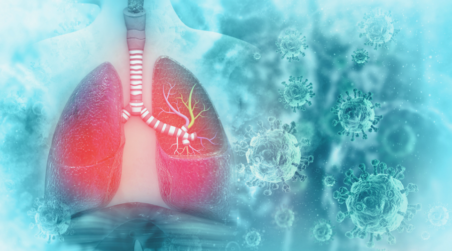 A computer-generated image of lungs and microbes