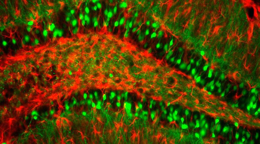 An intact section of a mouse brain showing a small subset of neurons expressing a genetically encoded fluorescent protein