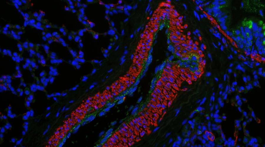 Pentachrome staining identifies arterial wall hypertrophy in BMPR2+/– lambs. 